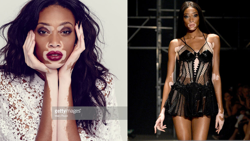 outfit thể thao của Winnie Harlow 0015